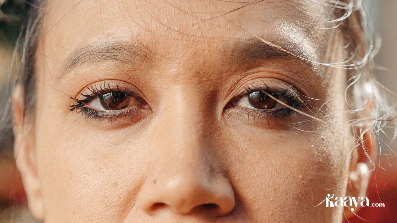 Best Ways To Get Rid of Eye Twitching