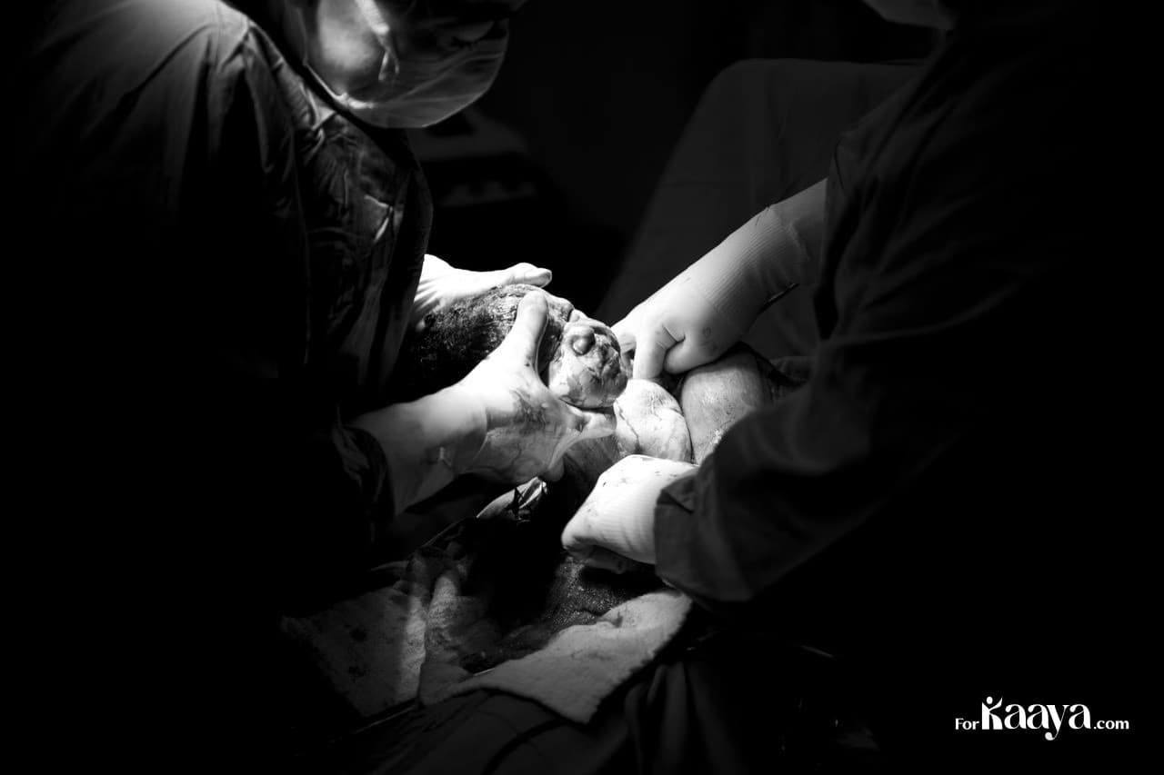 All about Cesarean section
